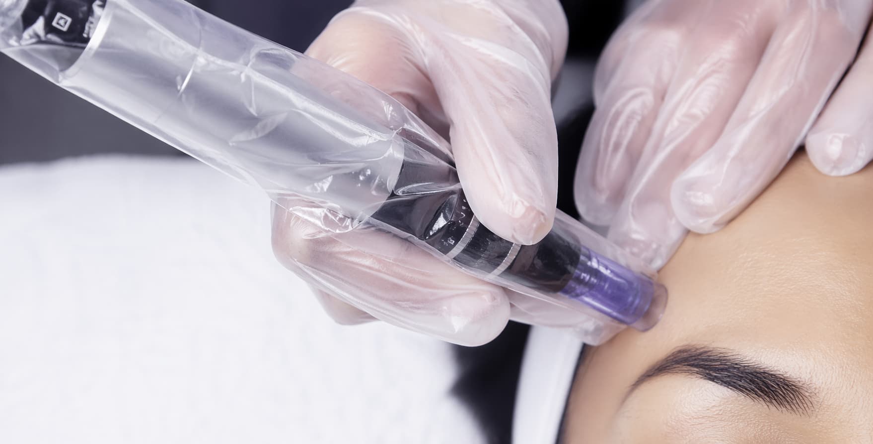 Wrapped microneedling pen
